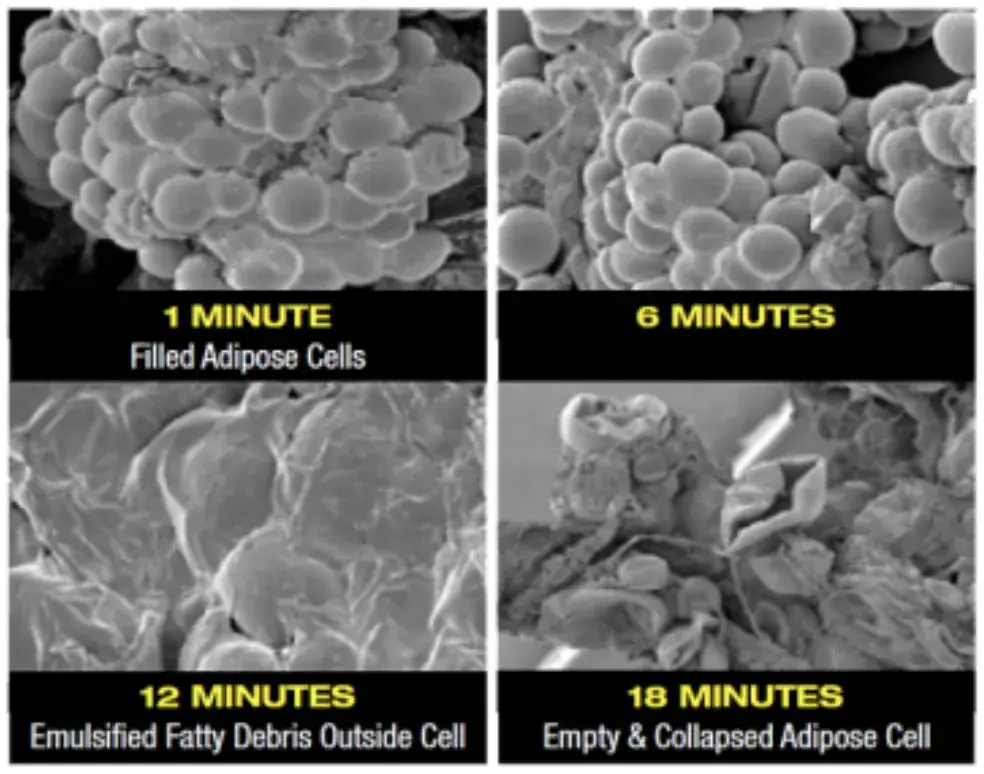 Fat Cells